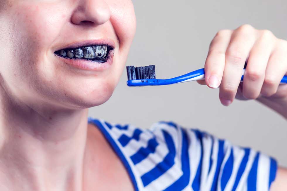 5 popularnih načina za izbeljivanje zuba kod kuće